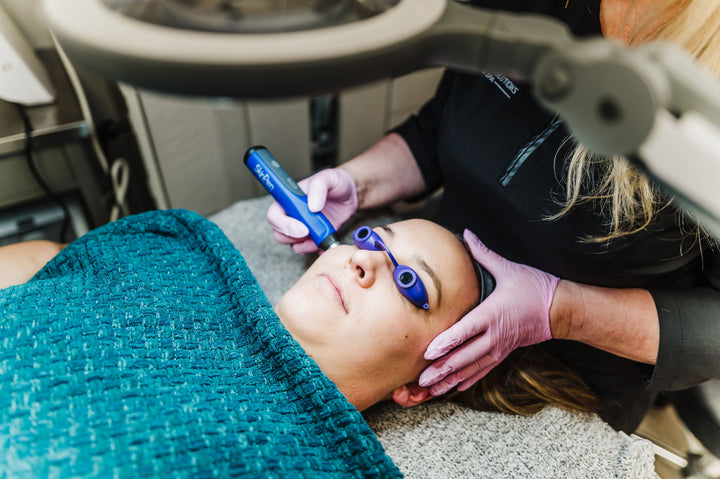 The Power of Microneedling: Unlocking the Benefits of Collagen Induction Therapy for Your Skin