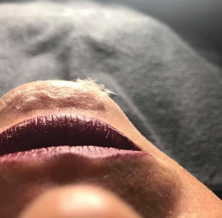 Discover the Wonders of Dermaplaning: Your Guide to a Glowing, Flawless Complexion