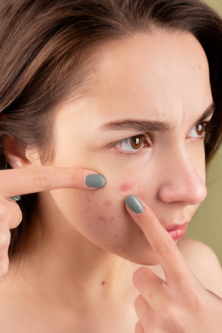 How to Know If You Have a Compromised Skin Barrier