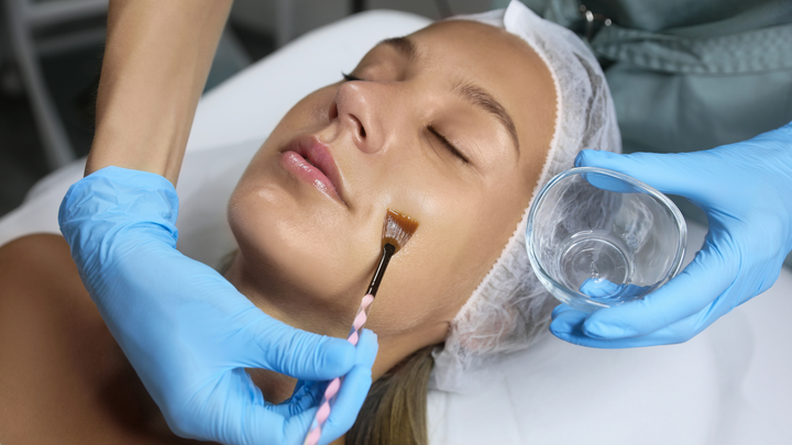 Demystifying Chemical Peels: The Ultimate Guide to Rejuvenating Your Skin in 2024