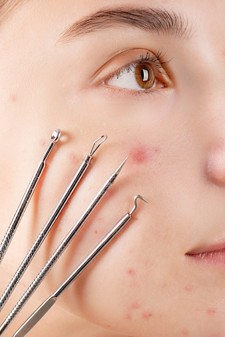 Acne is a Disease, Not a Condition: What to Know (and How to Treat It)